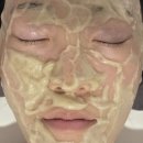 골드건 | 대전 에스테틱 끌리메 대전관저점 골드 페이스라인 관리후기
