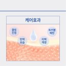 선피부관리 - 양평군 | 선피부관리
