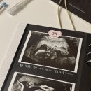 172 | 키 큰 임산부 임부복 | 24주 중기 임산부의 기록 | 172cm.. 후기엔 뭐입냐..