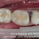 세인트치과 네이버블로그