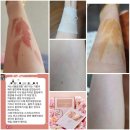 서지석 배우 추천 닥터에스오디 SOD 더블업플러스 7만박스 판매이유 (주)리쏘드