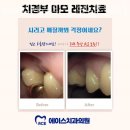 에이스치과의원 영등포문래동점 네이버블로그