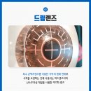 광주드림안과의원 네이버블로그