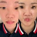 다나디톡스 | 정관 피부관리 올가드림뷰티 정관롯데캐슬점 모공 디톡스 후기