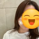 위례 동네에서 점 빼기, 아이디의원 후기