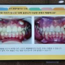왜 교정으로 유명할까? 경희대학교 치과병원 방문 후기