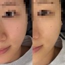 CU울산화봉송내점 | 🫧 울산 피부관리 올가드림뷰티 화봉점 | 예신 모공관리 솔직후기