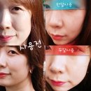 인셀덤we | 인셀덤 두달 후기