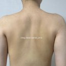 더모어 | 부산서면등드름 서면웨딩케어추천 당당한 오프숄더 더모어뷰티 서면본점 등드름완화후기