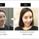 실스토리 네이버블로그