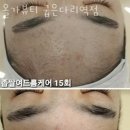 길동 피부관리 올가뷰티 굽은다리역점 위치.가격.시간.후기