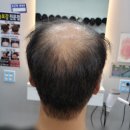 소피아헤어앤가발
