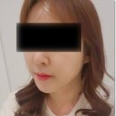 실버라이닝의원 | 송도줄기세포주사 받고 피부 달라진 리얼후기