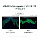 인셀덤신세계
