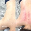 장유피부관리 고운피부바디샵에서 전신해독관리 받고 왔어요
