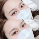 블랙래쉬 이미지