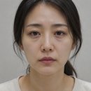 파인드피부과 | 압구정리프팅, 후기 찾아보기 전에 필독