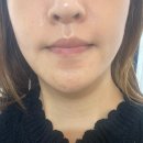 씨에이드림 | [전주 피부샵] 메이크유샤인(구 올가드림뷰티 신시가지점) / 트러블 피부, 색소침착, 미백관리 만족 후기