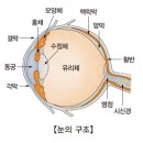 녹내장Glaucoma눈질환 이미지