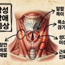말할 때마다 목이 조이는 느낌, 근긴장성 발성장애일 수 있습니다
