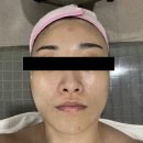 동안올인원뷰티 | 고양 지축 피부관리 동안올인원뷰티 솔직 후기