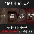 메디메이드 | 입냄새제거에 좋은 혀클리너 추천 프로벨 혀클리너 써본 솔직 후기