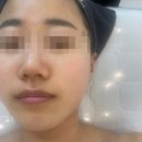 세미 스킨케어(Semi skin care) | 의정부 l 의정부피부숍 신곡동 피부관리 수분 물광 보습 관리 '오이유스킨케어'