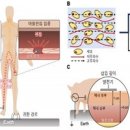 [2025 DAILY PICK 제123호] &#39;배터리 없는 &#39;전자약&#39; 기술 개발…걸을 때 발생하는 정전기로 신경 치료&#39; 등 이미지