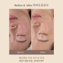 좋은피부관리 | 구미 어여쁘다 | 홍조·진정에 효과좋은 피부도로공사관리 후기