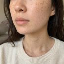 그린라이프코리아 | 그린아세로라C 항노화 영양제 섭취 후기