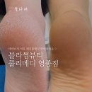 메디블라썸 | 인천 패디플래닝 운서역 풀리메디 영종도점 내성발톱관리도 가능해요