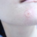 필메디케어 이미지