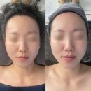 보경안전 | 중랑구피부관리 추천 :: 에스테티아 망우역점 윤곽관리 받고 30회 회원권 등록한 후기