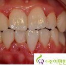 아중이편한치과 네이버블로그