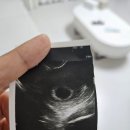 다정한산부인과의원 이미지