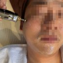 파브 | 상도동피부관리 추천 파브온스킨 후기