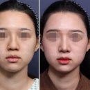 잇츠비의원 이미지