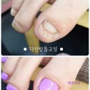 예꼼네일