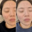 강동-천호-2438 이미지