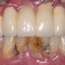 이안치과기공소 이미지