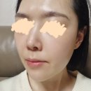 온더아셀