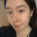 하프타임 | 신사역 올타이트 리프팅 통증 적고 다운타임 없음, 얼굴패임없이 하프해진 클리닉 후기