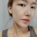 디엔에이소프트 | 가격 비싼 피부과아기주사(베네브), 먼저 MTS 홈케어로 시작하셔요.