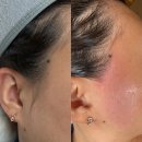 디와이샵 | [청주 율량동/왁싱맛집] 인상이 깔끔해지는 지름길 - 페이스왁싱 받고 달라진 후기 (디와이뷰티)