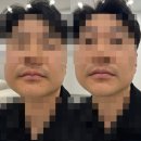 24.08.02 ~ 08.06 (금~화) - 오빠 레이저 제모 Ι 사운드바 설치 Ι 칭구들 만남 Ι 가족 회식