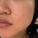 아름다운약국 | 🌿✨ 파리 약국 픽! 윤광 피부 완성템 NYM 펀더멘탈 스킨케어 오일 &amp; 님 페이스 오일 후기