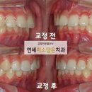 연세미소담은치과 이미지