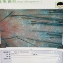 이안두피탈모 이미지