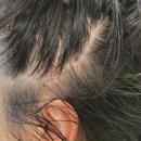 11650-16-168-5 | 가산 두피관리 어디가 좋을까? 5년째 다니는 숲칼프 가산점 후기 (문제성두피·탈모관리)