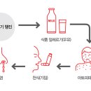 알레르기 이미지